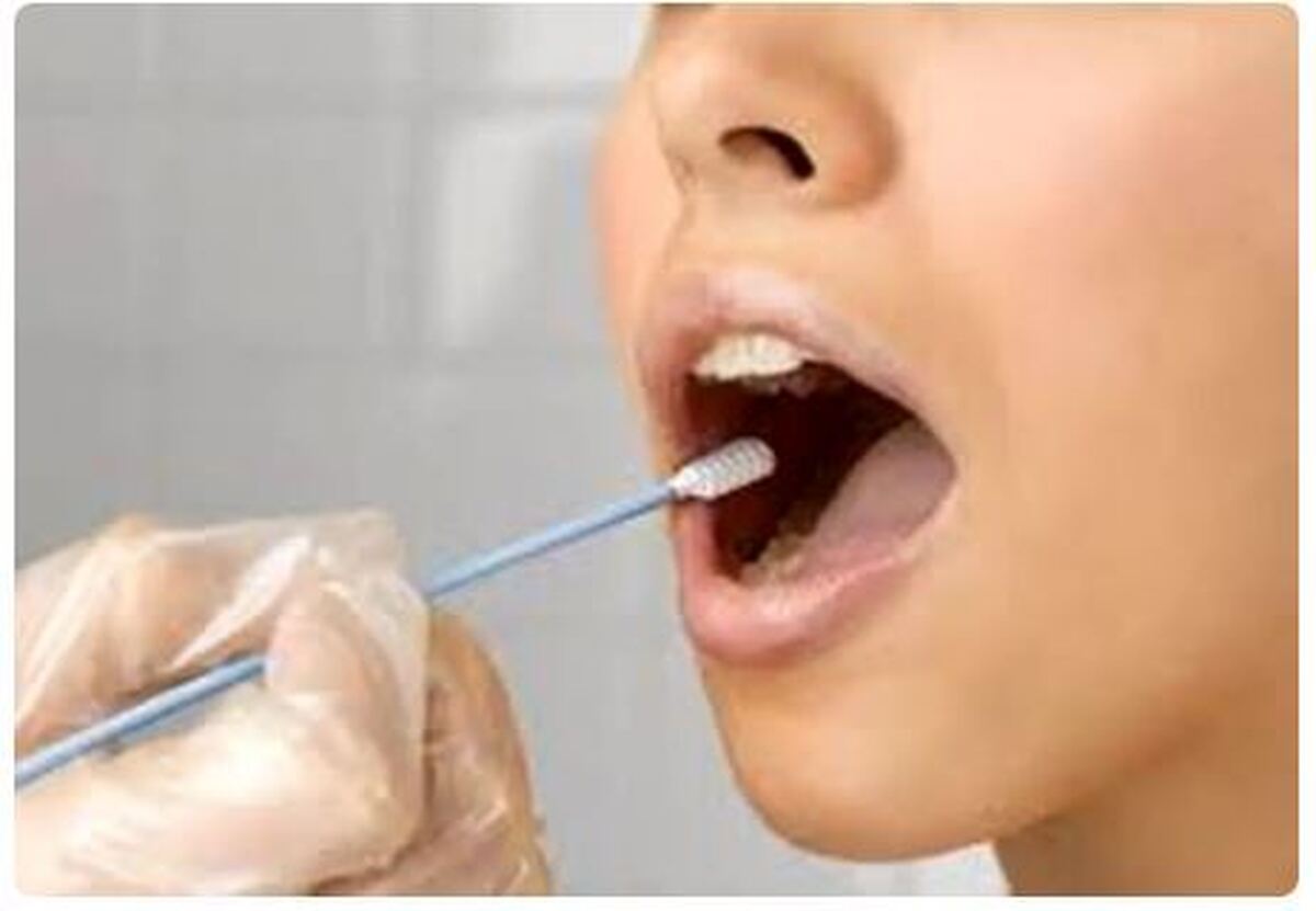 بررسی علل مختلف زرد شدن زبان +راه درمان