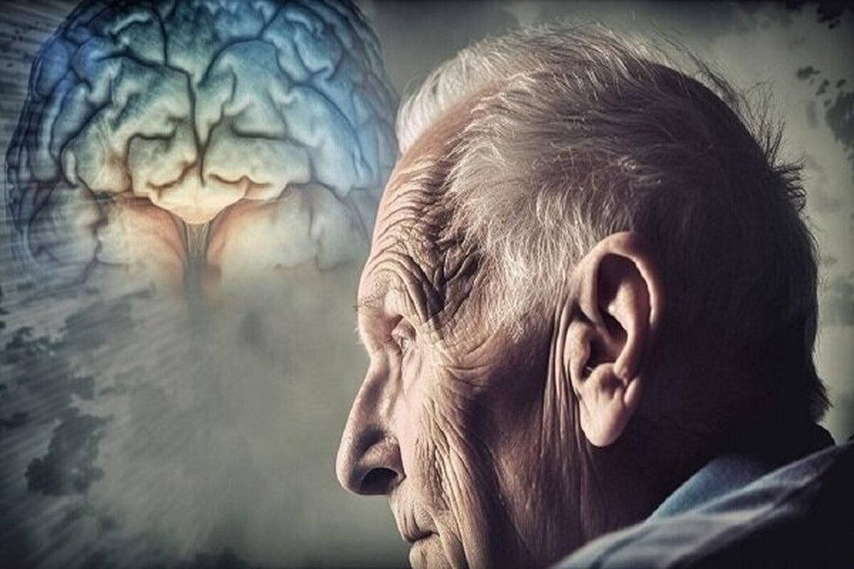 سکته مغزی یکی از نشانه‌های پیری زودرس!