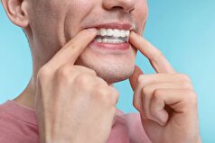 روشی برای تشخیص دیابت بر اساس وضعیت حفره دهان نامگذاری شده است