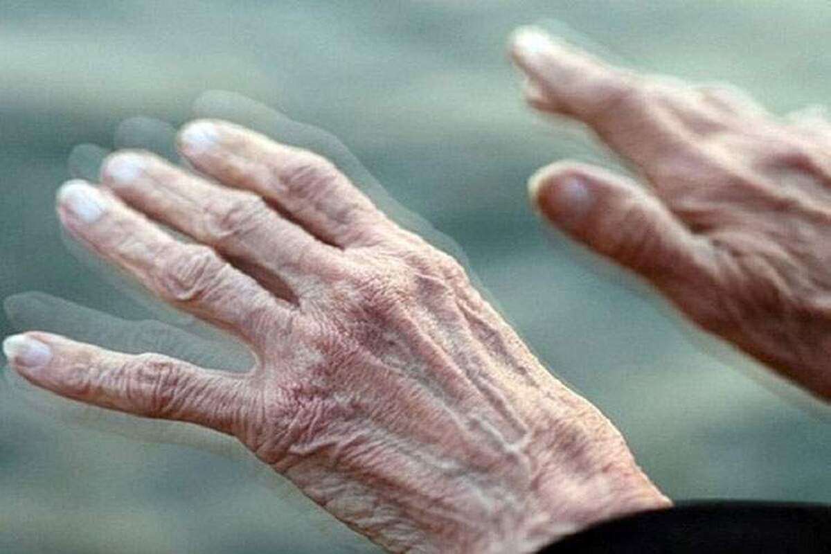 پارکینسون میتواند ناشی از جهش ژنتیکی باشد!
