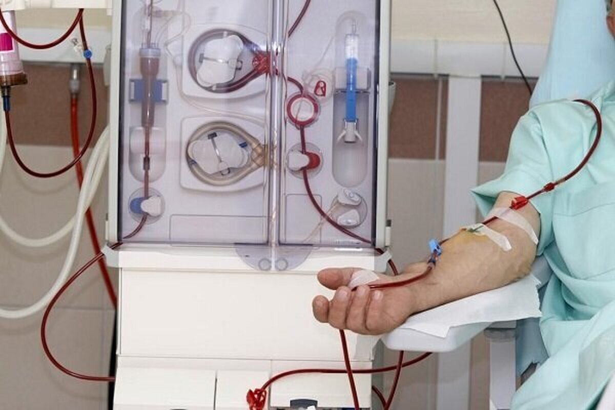 چگونه از شیوع بیماری سنگ کلیه جلوگیری کنیم؟