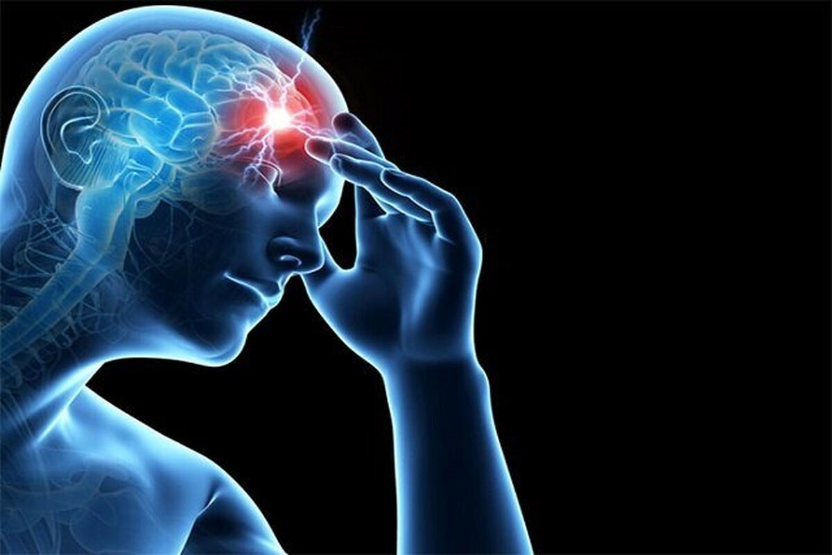 سکته‌های مغزی مکرر می‌توانند به زوال عقل عروقی منجر شوند