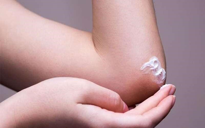 لطافت پوست زانو و آرنج و رفع تیرگی‌ها به کمک راهکار‌های خانگی!