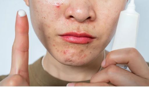 هممه چیز درمورد نحوه مصرف و فواید رتینول برای پوست!
