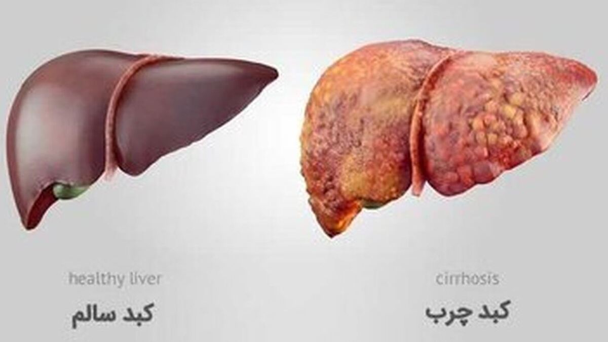 به کمک این ویتامین‌ها سلامت کبد را تقویت کنید