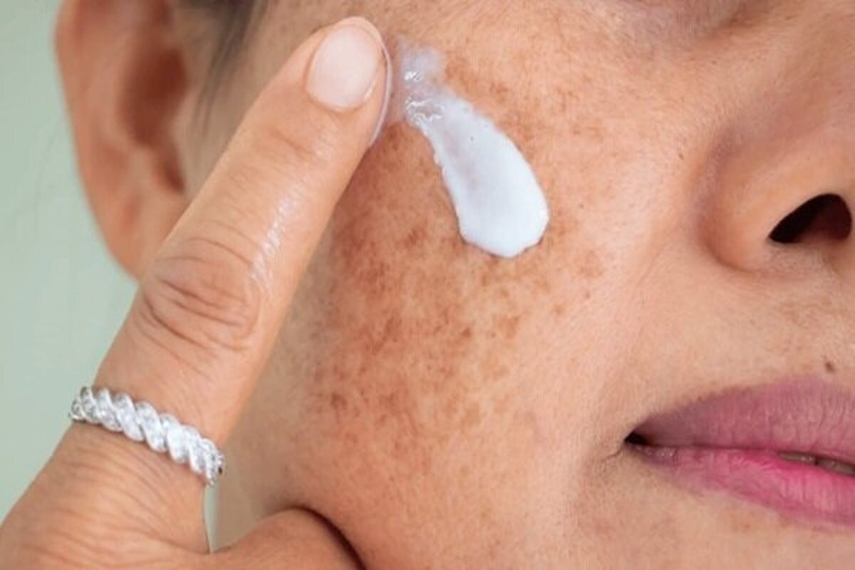 کاهش رطوبت طبیعی بدن چه تاثیری بر سلامت پوست دارد؟