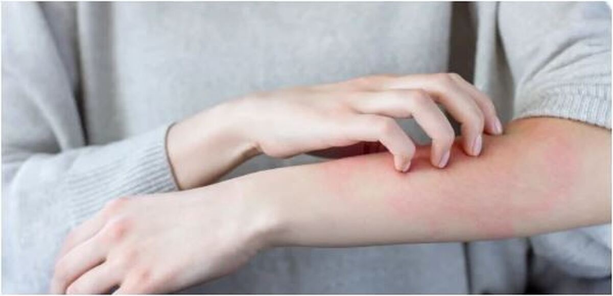 از کنار خارش‌های عجیب بدن به راحتی عبور نکنید!