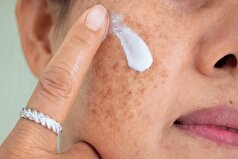 کاهش رطوبت طبیعی بدن چه تاثیری بر سلامت پوست دارد؟