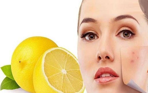 رفع لک‌های پوستی و جوش با لیمو ترش!