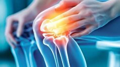متخصصان ژنتیک مکانیسم ایجاد پوکی استخوان ایدیوپاتیک را کشف کرده‌اند