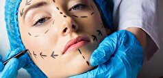 وزارت بهداشت حدود صلاحیت پزشکان عمومی در حوزه زیبایی را دقیقا مشخص کند