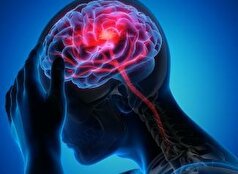 ابتلای ۱.۴ میلیون ایرانی به صرع/ میگرن شایع‌ترین نوع سردرد