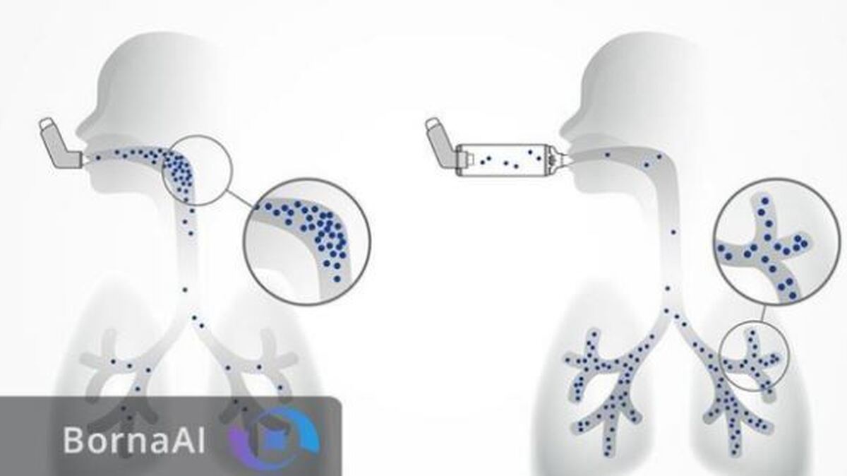 یک اختراع جدید برای درمان سرطان که به ثبت رسید