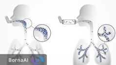 یک اختراع جدید برای درمان سرطان که به ثبت رسید
