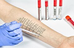 پزشک نوع آلرژی غیرقابل درمان را شناسایی کرد