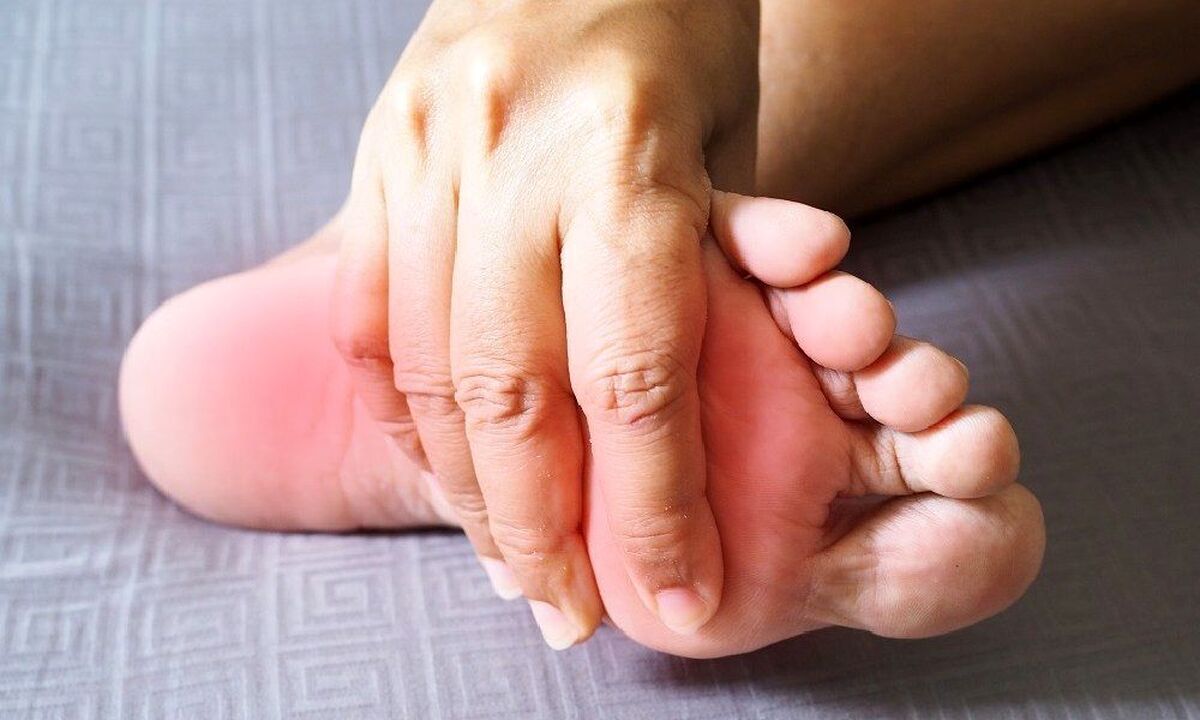 چه بیماری‌های دیگری غیر از نقرس باعث درد کف پا می‌شود؟