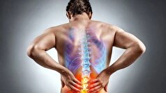 چرا صبح‌ها کمردرد دارید؟ بخوانید!