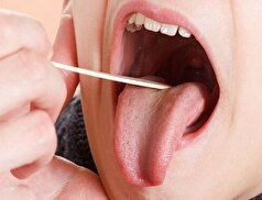 عللی که باعث ایجاد ترک روی بدن می‌شوند را بدانید