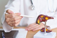 آزمایش‌هایی برای تشخیص بیماری کبد چرب قبل از بروز علائم نامگذاری شده‌اند