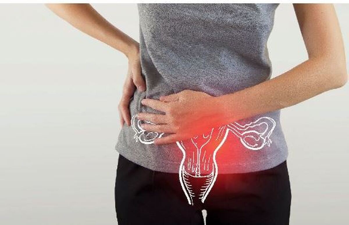 بررسی علائم ظاهری و باطنی تنبلی تخمدان در زنان و دختران
