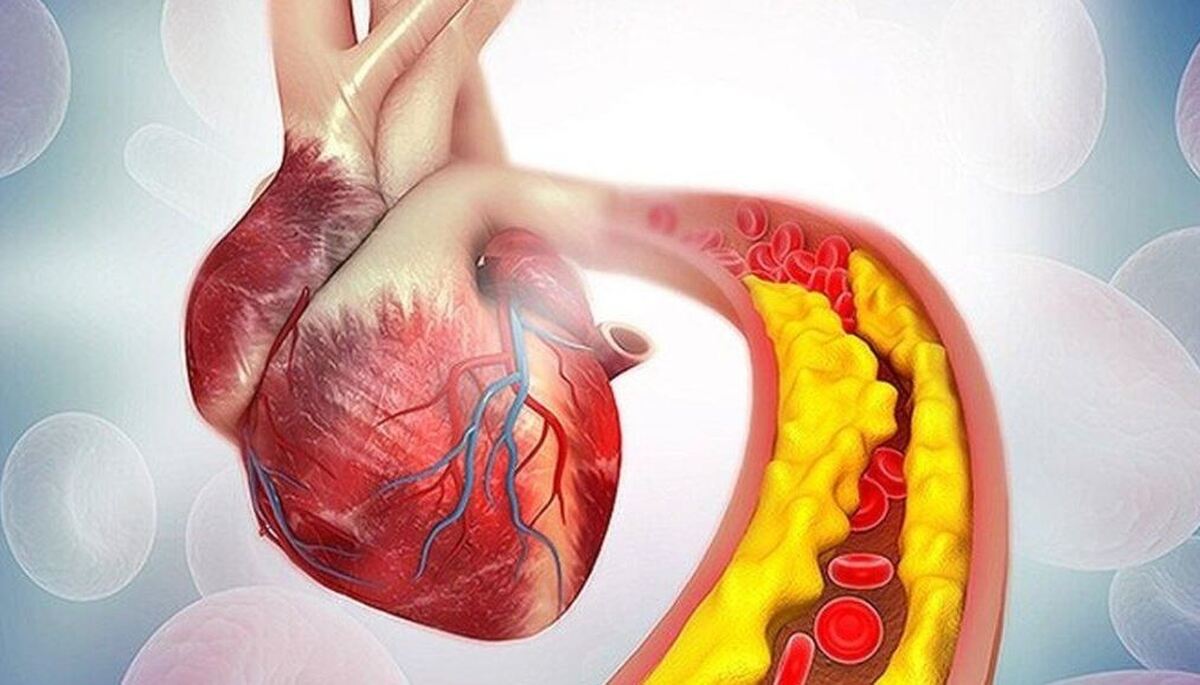 چگونه بدون استفاده از قرص و دارو فشارخون را کنترل کنیم؟