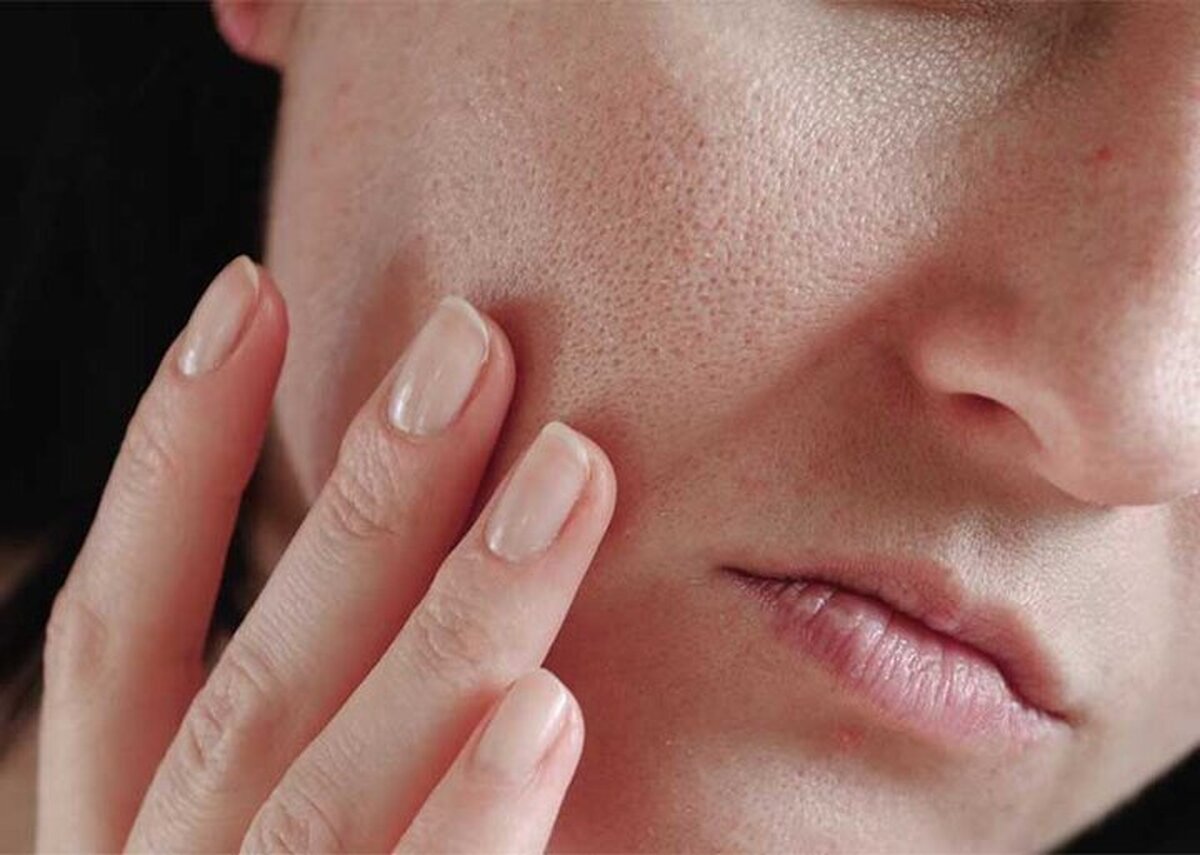 کاهش چین چروک‌های پوست با خوردن توت!