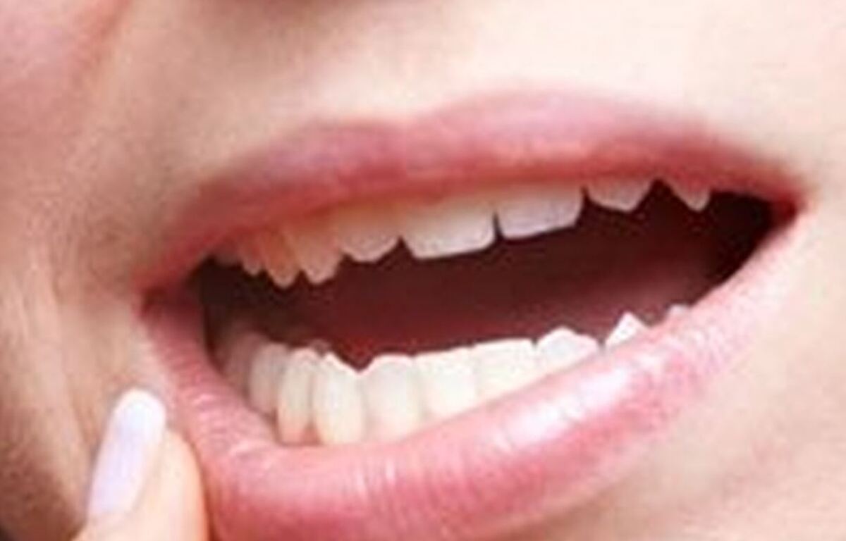 راهکار‌های خانگی برای التیام زخم دهان