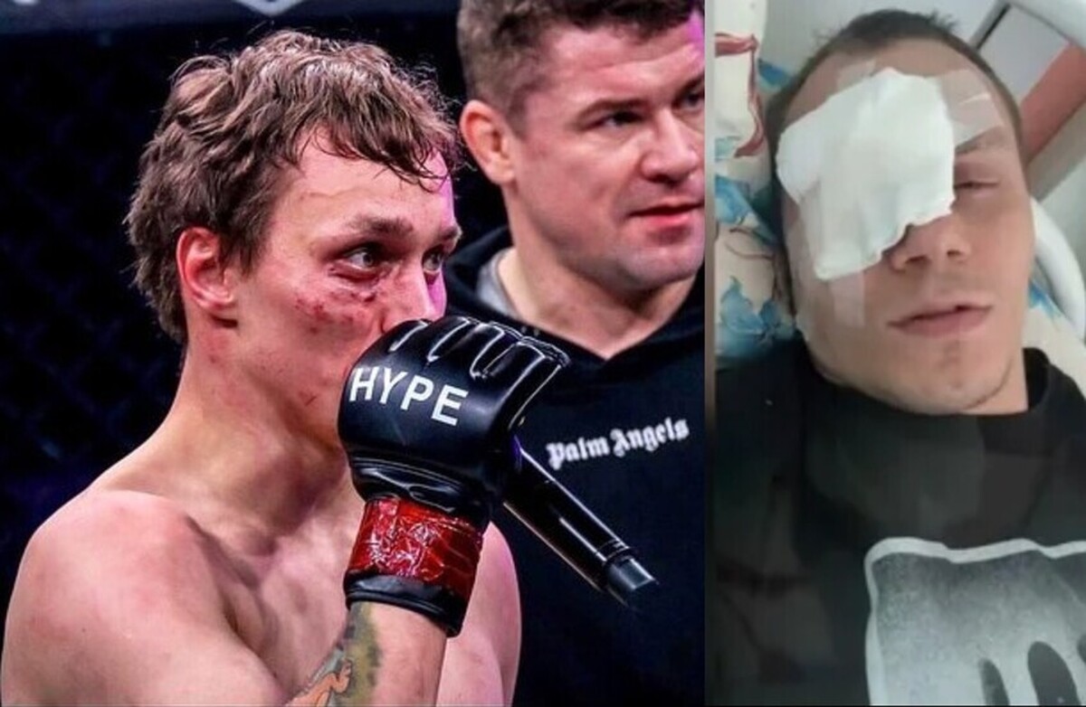 حادثه تکان دهنده: مبارز MMA در دعوا با دختر، یک چشم خود را از دست داد