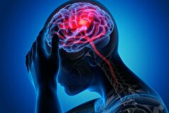 سکته مغزی سراغ چه کسانی میرود؟