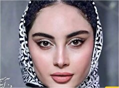نگاهی به چهره پر از تغییر ترلان پروانه بعد از تزریق‌های فراوان! +عکس