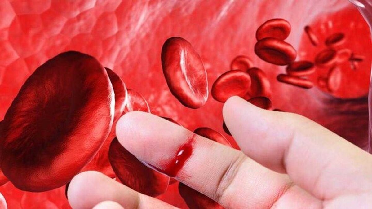 بیماری هموفیلی را چگونه کنترل کنیم؟