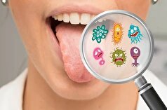 ویروس موجود در دهان ممکن است خطر حمله قلبی را افزایش دهد