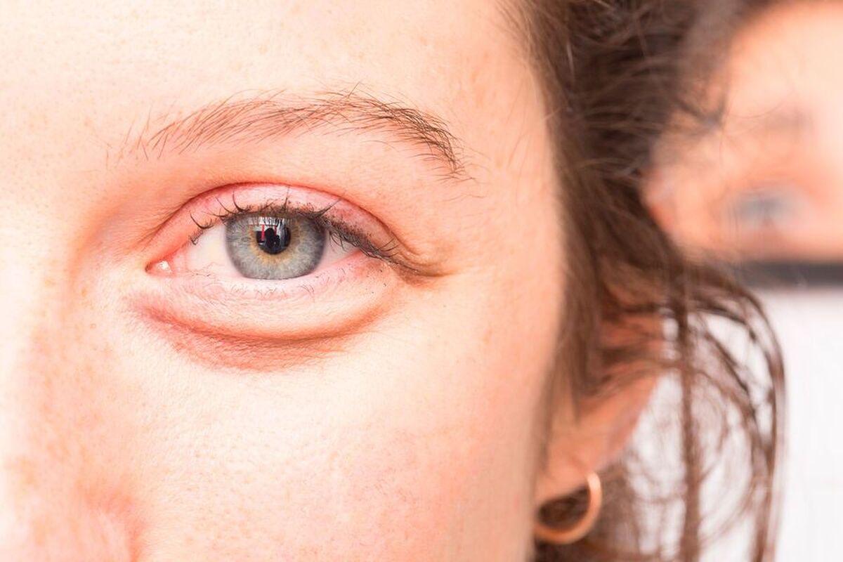 چگونه هنگام کار در گرما سلامت چشم خود را حفظ کنیم