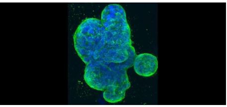 عفونتهای تنفسی رایج سلولهای سرطانی خفته را فعال میکنند! عفونتهای تنفسی رایج سلولهای سرطانی خفته را فعال میکنند!