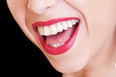 محققان دریافتند که چگونه باکتری‌های دهان، آرتروز را بدتر می‌کنند