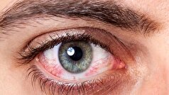 چه خطرات چشمی در مسیر پیاده‌روی اربعین وجود دارد؟