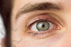 اشتباهات غیر واضحی که بینایی را 