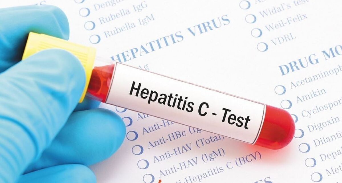 چه عواملی باعث شیوع هپاتیتهای ویروسی میشود؟