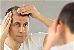 توصیه‌های یک متخصص تغذیه برای زیبایی پوست و مو‌ها