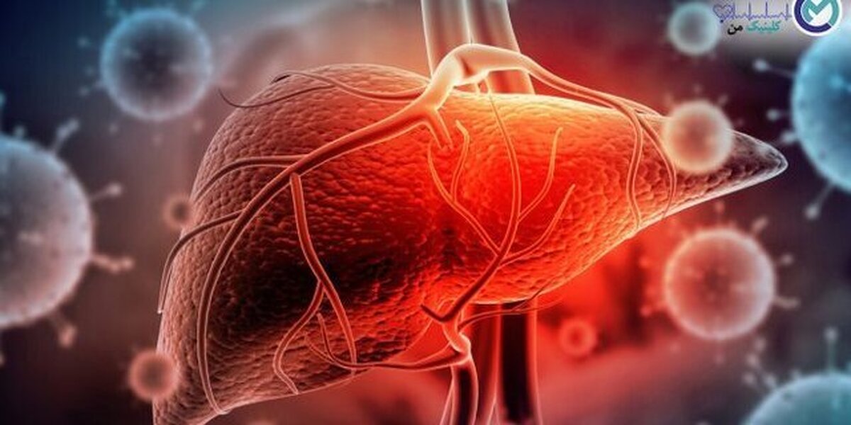 یزد، همگام با طرح ملی در راستای حذف هپاتیت