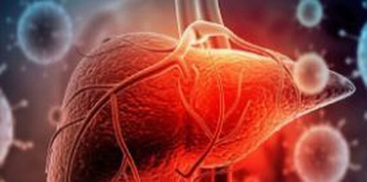 بیشتر سرطان‌های کبد قابل پیشگیری هستند