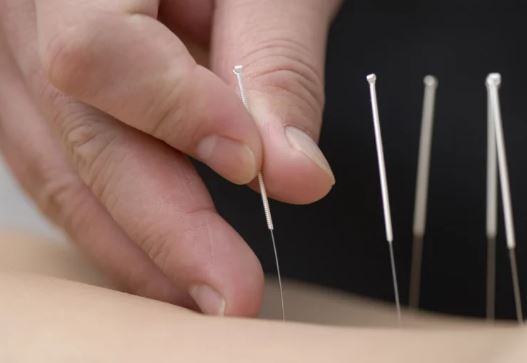 یک روش سنتی و بی ضرر برای جوان‌سازی پوست بدون تزریق یا جراحی!