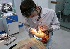 ۱۷.۵۲ درصد از بزرگسالان ایرانی دندان ندارند!