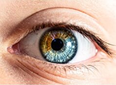 بیماری کلیه در چشم چگونه بروز میکند؟