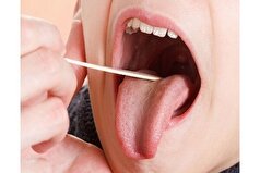 سوزن سوزن شدن زبان چه علتی دارد؟