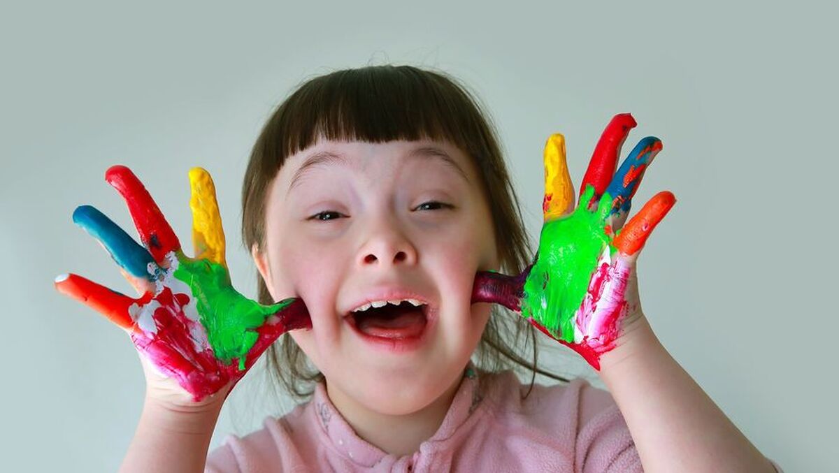 دانشمندان برای اولین بار یک کروموزوم اضافی را از یک بیمار مبتلا به سندرم داون حذف کردند