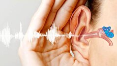 برای جلوگیری از آسیب‌های جدی شنوایی این نکات لازمتان میشود!