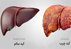 روند پیری کبد را اینگونه کند کنید!