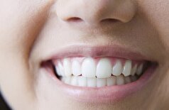 راهی برای حفظ سلامت دندان بدون استفاده از دارو