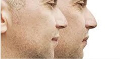بدون جراحی غبغب خود را کوچک کنید!